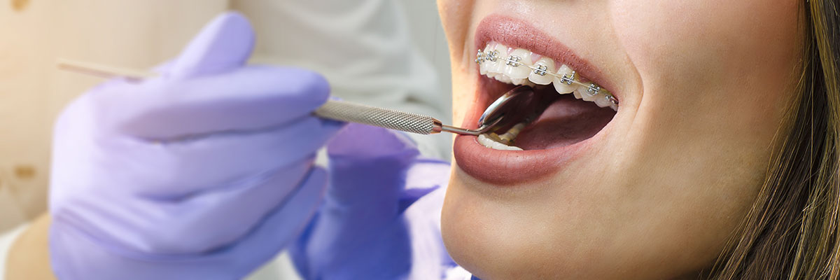 Ortodontie dentaire